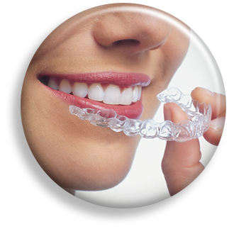 Clear Aligners